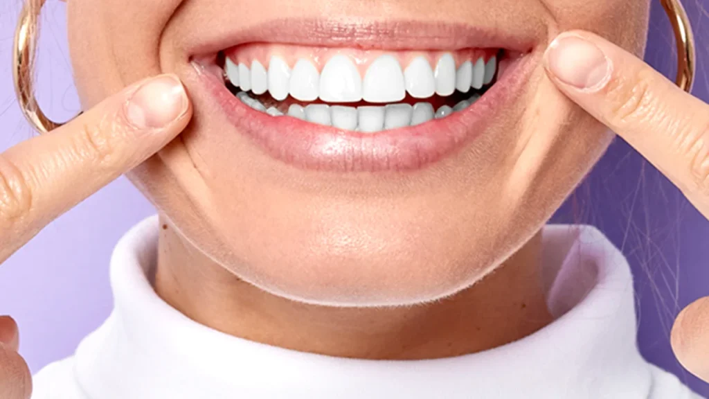 A close-up of a woman smiling brightly, pointing at her perfect white teeth