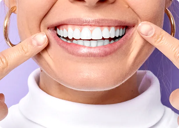 A close-up of a woman smiling brightly, pointing at her perfect white teeth